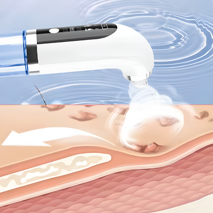 Skiniq™ Elektromos Pórustisztító Pro