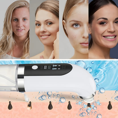 Skiniq™ Elektromos Pórustisztító Pro